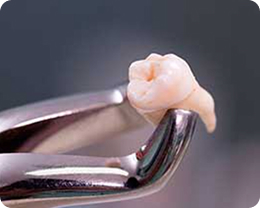 Extractions