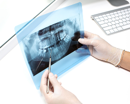 Dental X-Rays